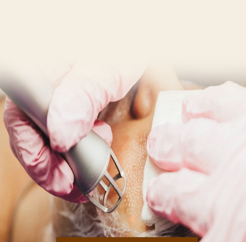 CO2 fractional laser skin resurfacing
